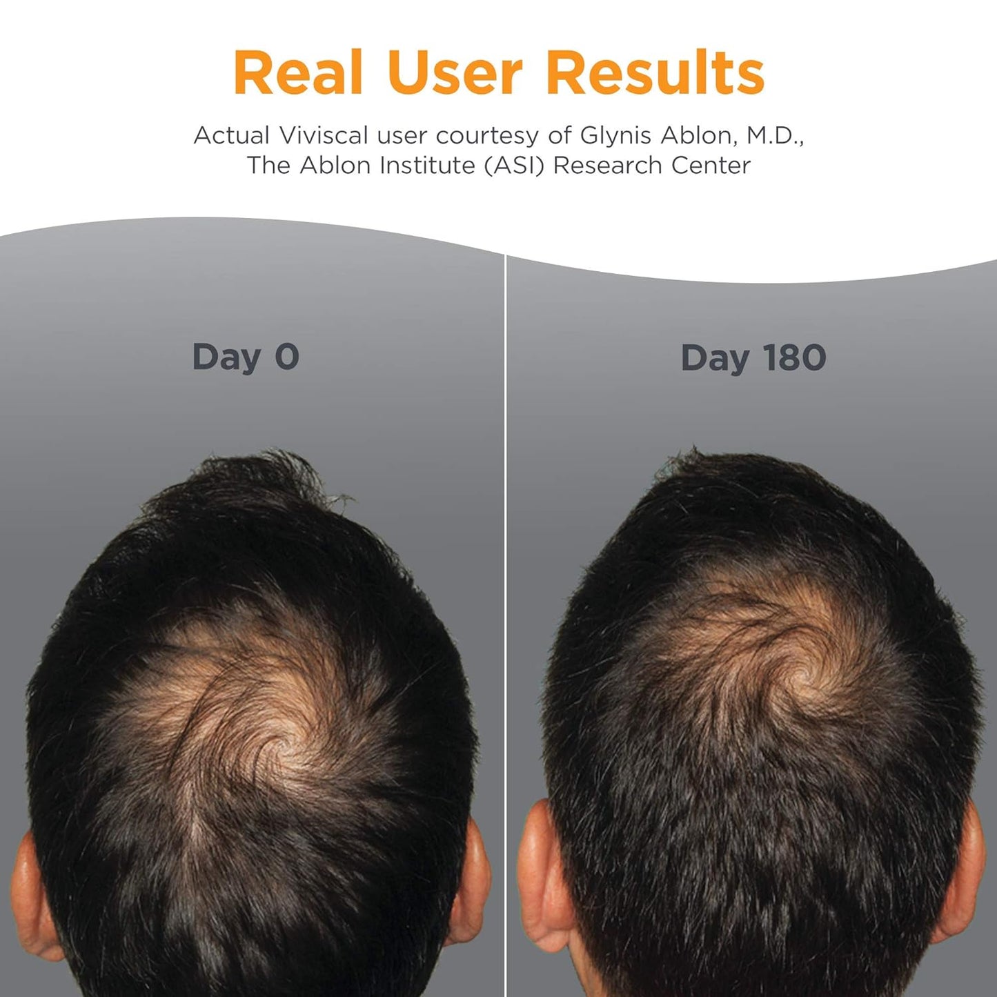Men's Hair Growth Supplement